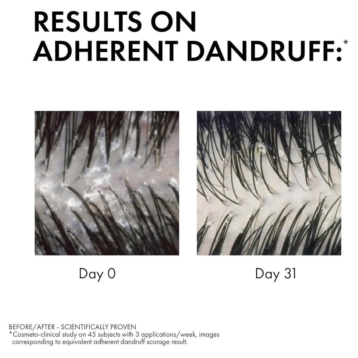Vichy Dercos Anti-Dandruff Shampoo