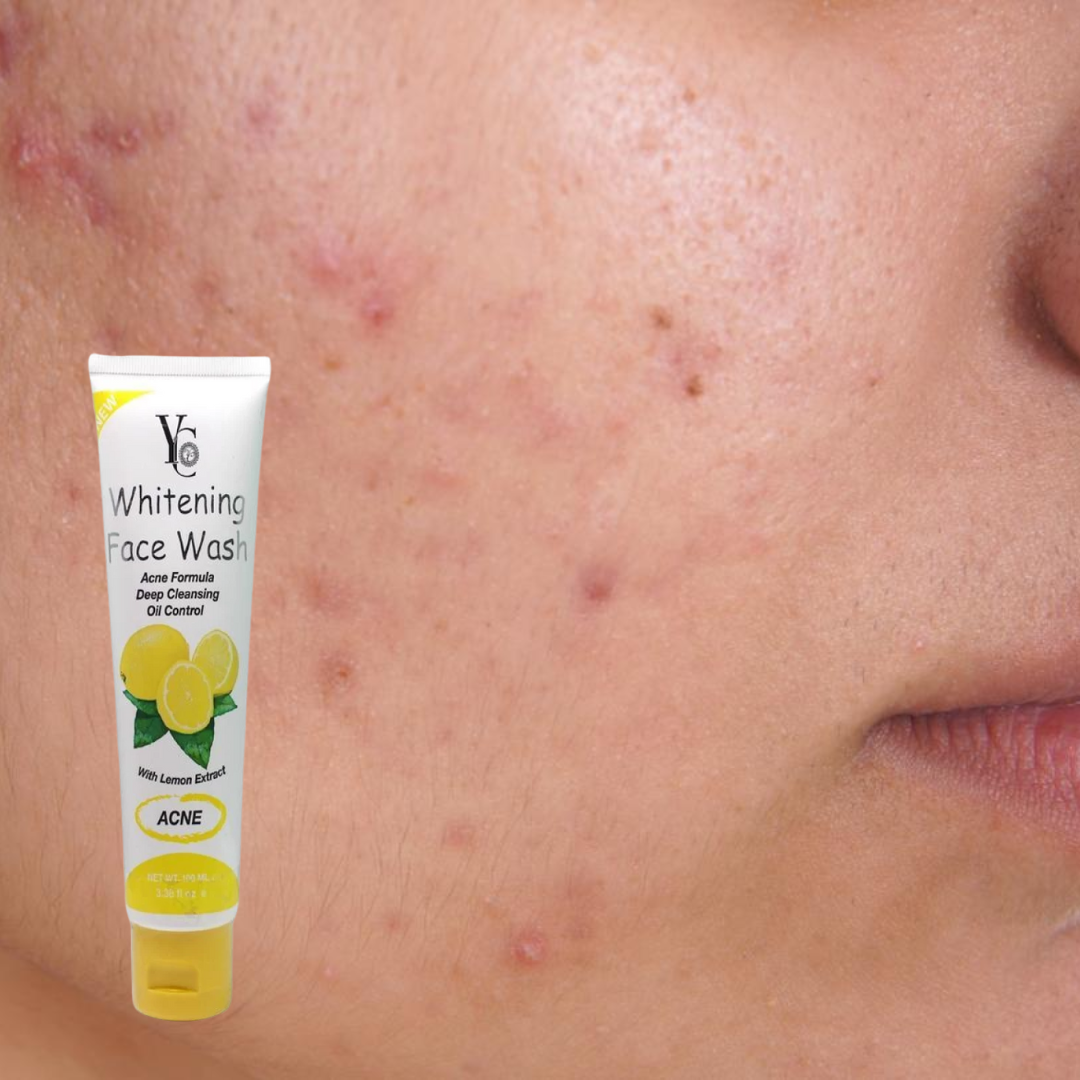 YC Whitening Face Wash-Lemon Extract
