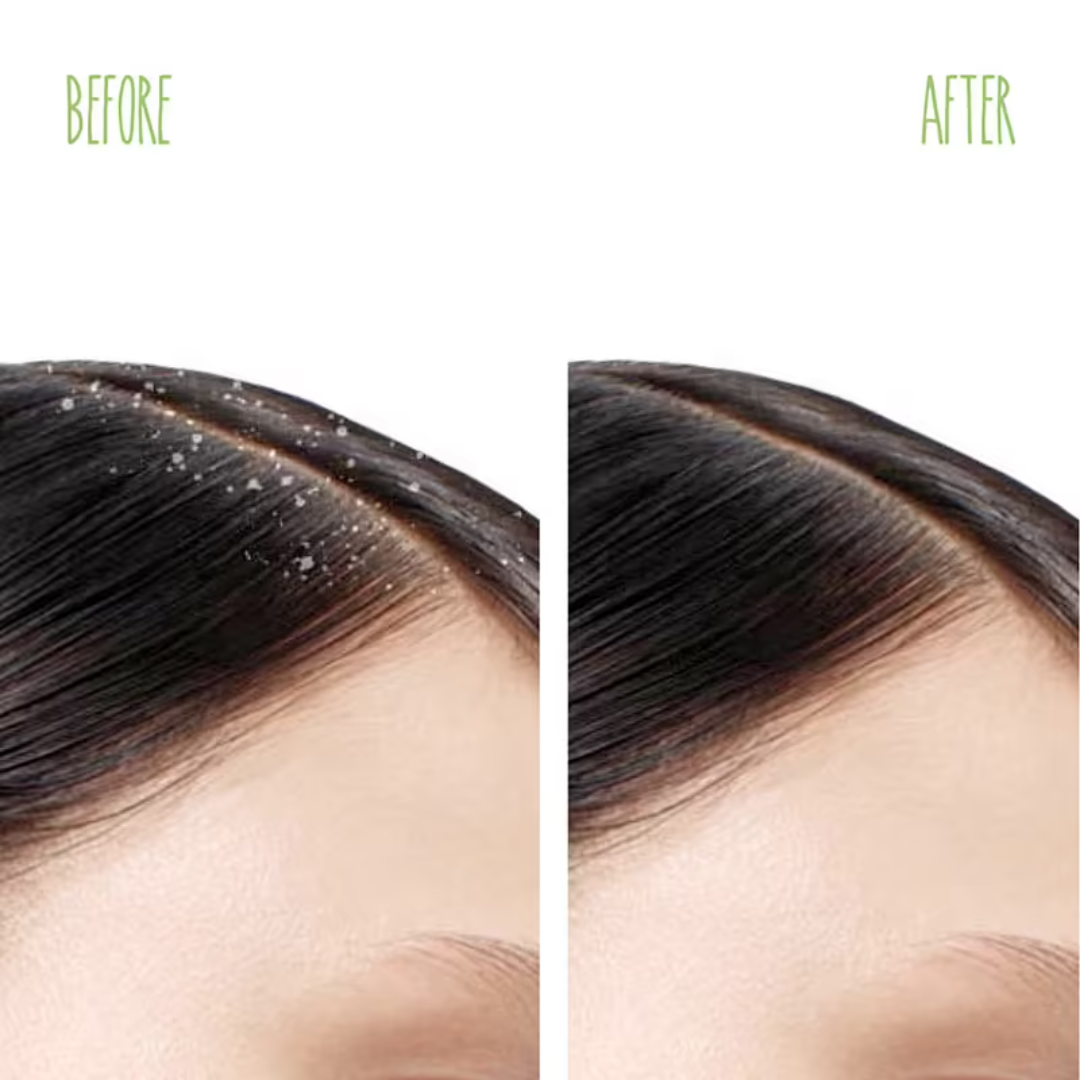 Matrix Biolage Scalppure Conditioner before & After