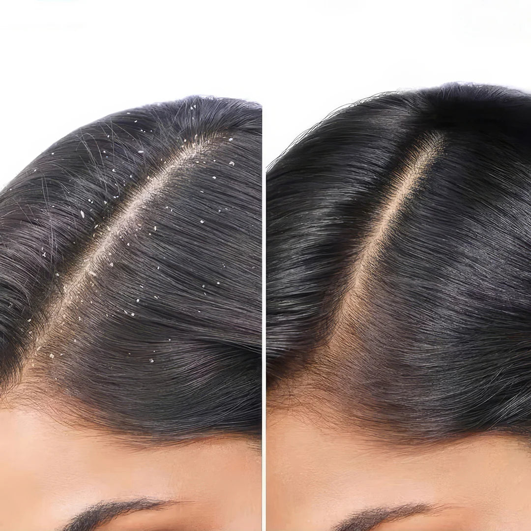 argan de luxe Anti Dandruff Shampoo clear scalp