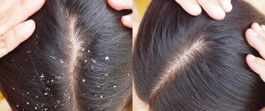 Matrix Biolage Scalp pure Shampoo 1L