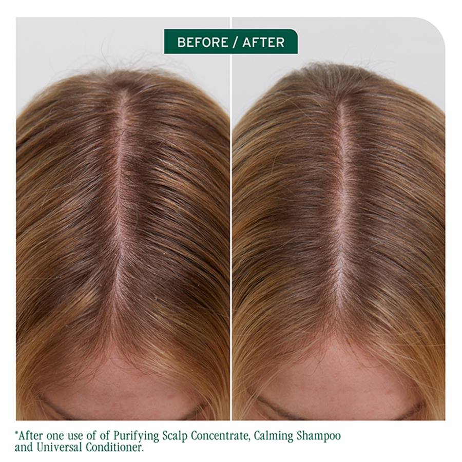 Biolage Scalp Sync Balancing Concentrate