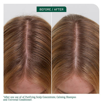 Biolage Scalp Sync Balancing Concentrate