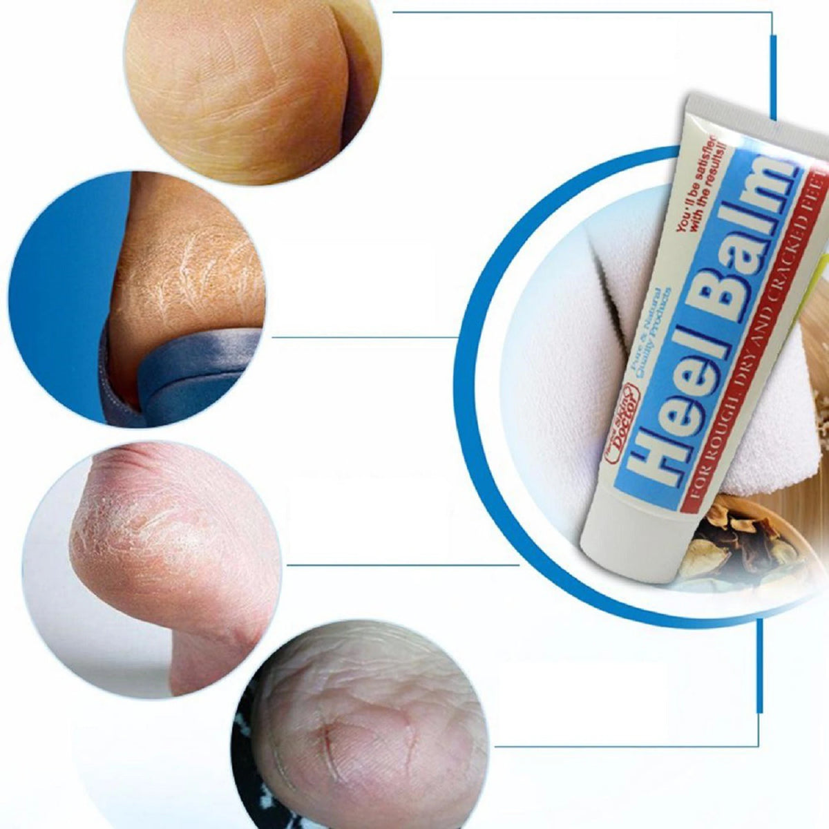 Skin Doctor Heel Balm