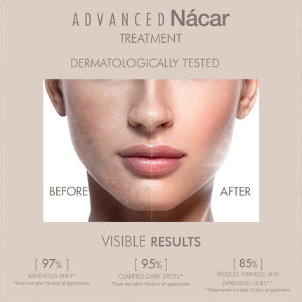 Casmara Nacar Treatment Facial Kit
