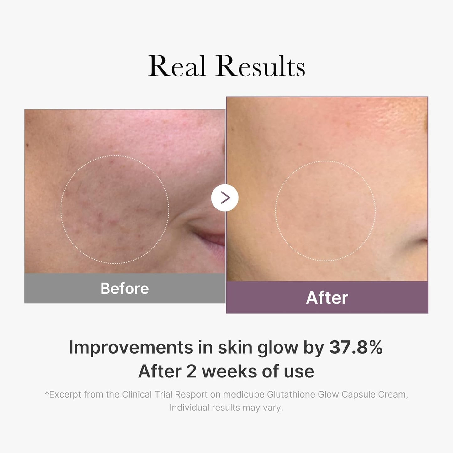 Age-R Glutathone Glow Capsule Cream
