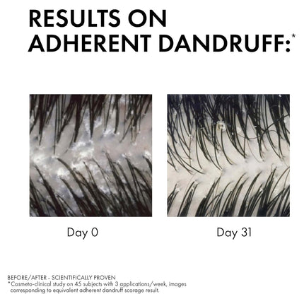 Vichy Dercos Anti-Dandruff Shampoo