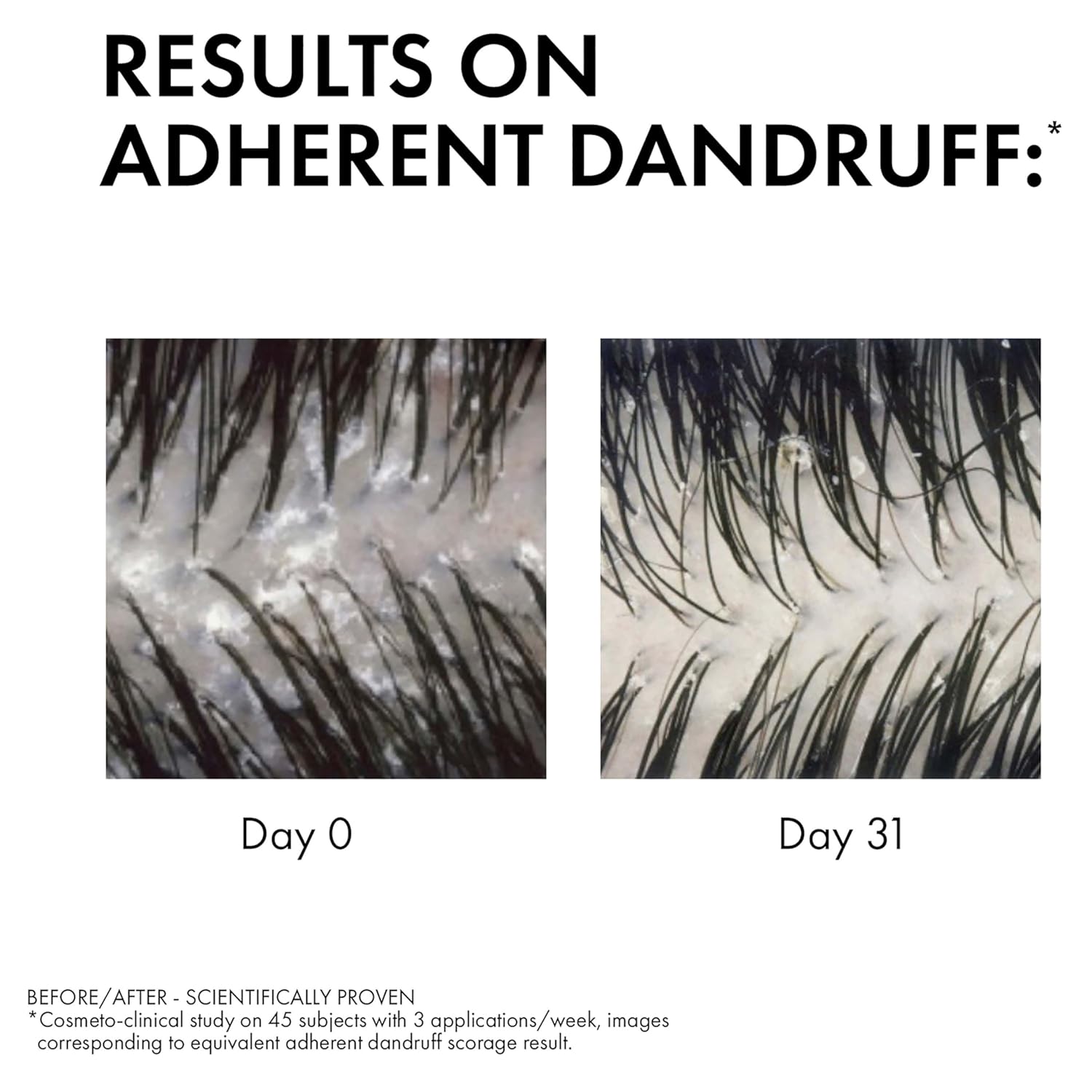 Vichy Dercos Anti-Dandruff Shampoo