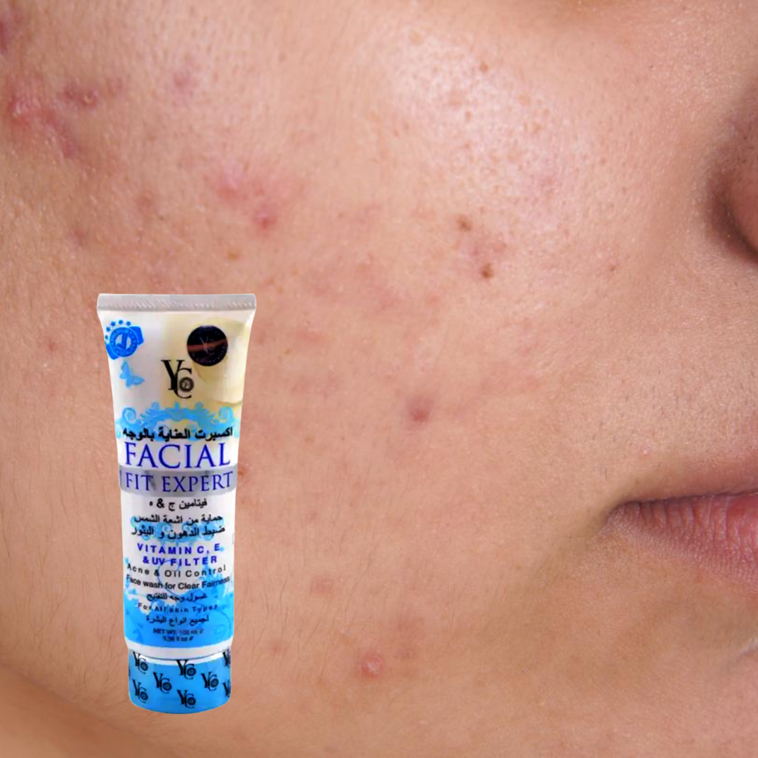 YC Facial Fit Expert Acne & Oil Control Face Wash