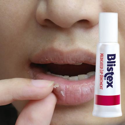 Blistex Medicated Lip Ointment