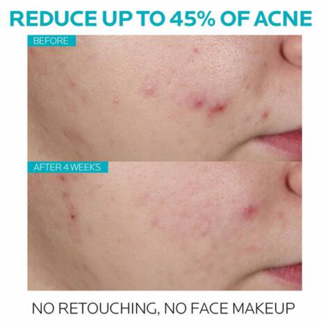 La Roche-Posay Effaclar Serum