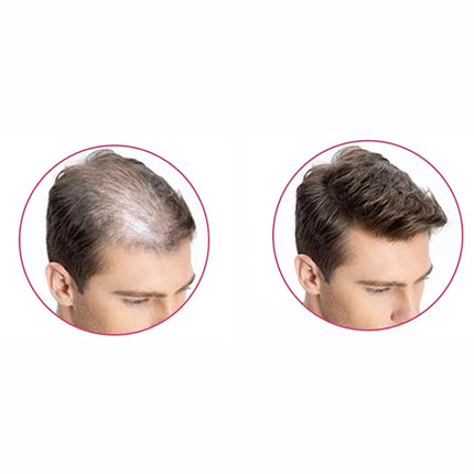 Shills Hair building Fibers Black