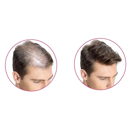 Shills Hair building Fibers Dark brown