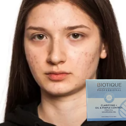 Biotique Professional Clarifying Oil & Pimple control Nourishing Gel