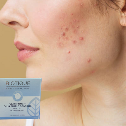 Biotique Professional Clarifying Oil & Pimple control Nourishing Gel