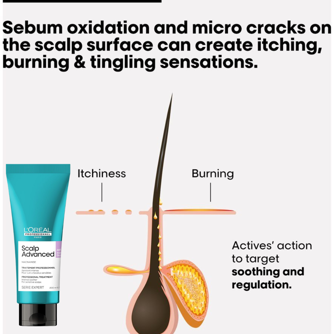 L'Oreal Scalp Advanced Anti Discomfort Treatment