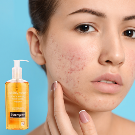 Neutrogena Spot Clearing Face Wash, 200ml