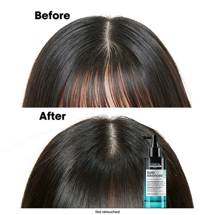 Scalp Advanced 5-in-1 serum
