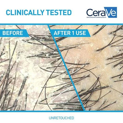 CeraVe Anti-Dandruff Hydrating Shampoo