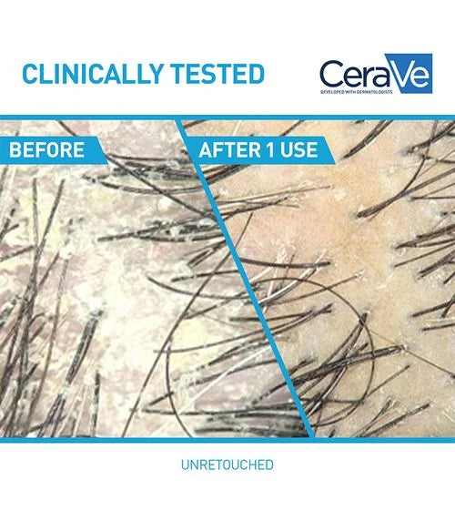 CeraVe Anti-Dandruff Hydrating Shampoo