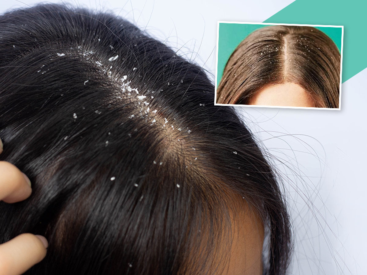 Schwarzkopf Professional BC Bonacure Anti-Dandruff Shampoo